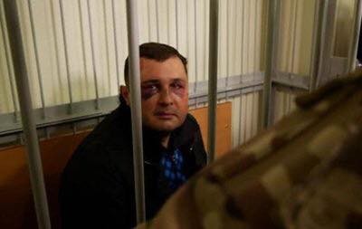 СБУ задержала и «в рамках закона» сломала челюсть бывшему депутату Верховной Рады