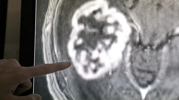 Сила света: российские ученые создали новый метод лечения рака